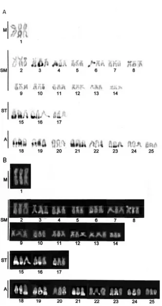 Figure  5  -  Astyanax  sp.  D.  triploid  A)  Restriction  enzyme  AluI-treated  karyotype;  B)  CMA 3 - -stained karyotype