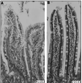 Figure 3 - Histological differences between control and experimental rats. (A) Villi aspects of an  experimental rat, with presence of congestion and increased leukocyte infiltration