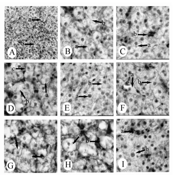 Figure 2 - Liver tissue of  C. mrigala. (A) control - (a) hepatocyte, (b) sinusoid. H&amp;E, x 250; (B)  exposed to 0.91 ppm dichlorvos