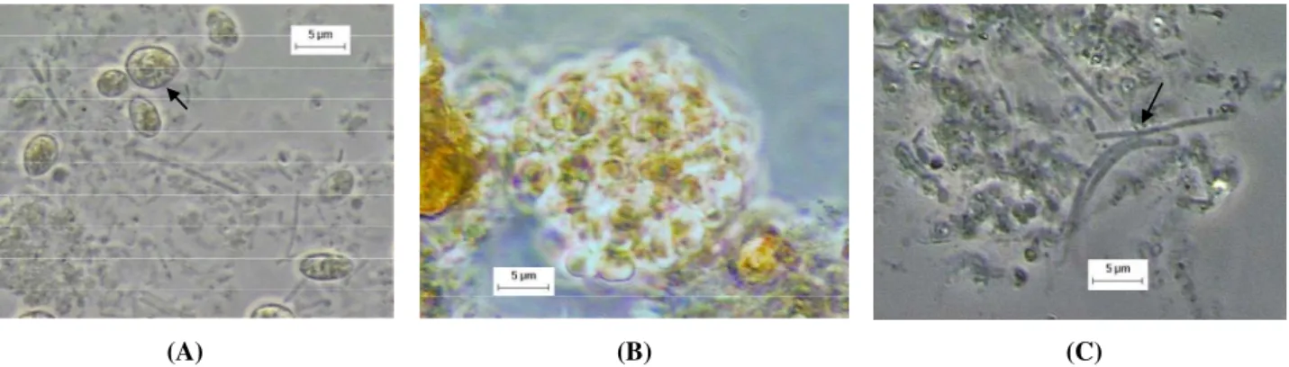 Figure 2 - Observed morphologies by optical microscopy (1500X): (a) diversity of rods and yeast  S
