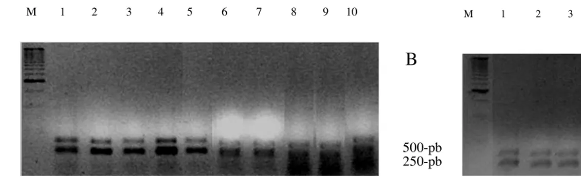 Figure  7  -  Restriction  profiles  of  the  products  of  the  amplification  of  the  gene  cap20  with  restricition enzyme MspI (A e B)