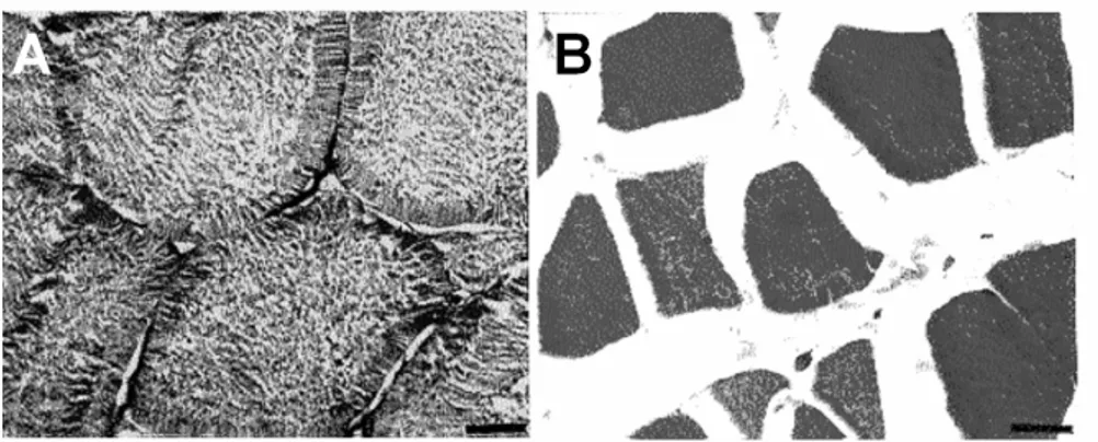 Figure 2 - Transverse section of epaxial muscle of Hoplias malabaricus: (A) fed (control), and (B)  starved for 240 days
