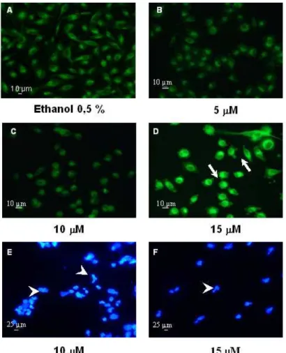 Figure  3  -  Curcumin  induced  morphological  alterations  and  nucleus  fragmentation  in  human  melanoma cells