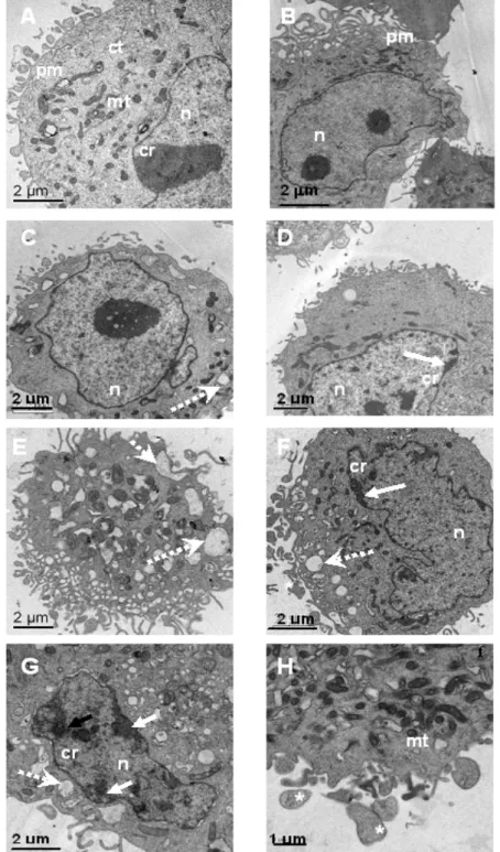 Figure  4  -  Transmission  electron  micrographs  of  curcumin-treated  human  melanoma  cells