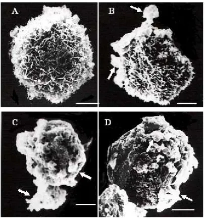 Figure 5 - Scanning electron micrographs of curcumin-treated human melanoma cells Membrane  blebs (arrows) could be clearly seen in melanoma cells treated with 10 µM, 15 µM and  20  µM  of  curcumin  for  24  hours  (B,  C,  D),  respectively