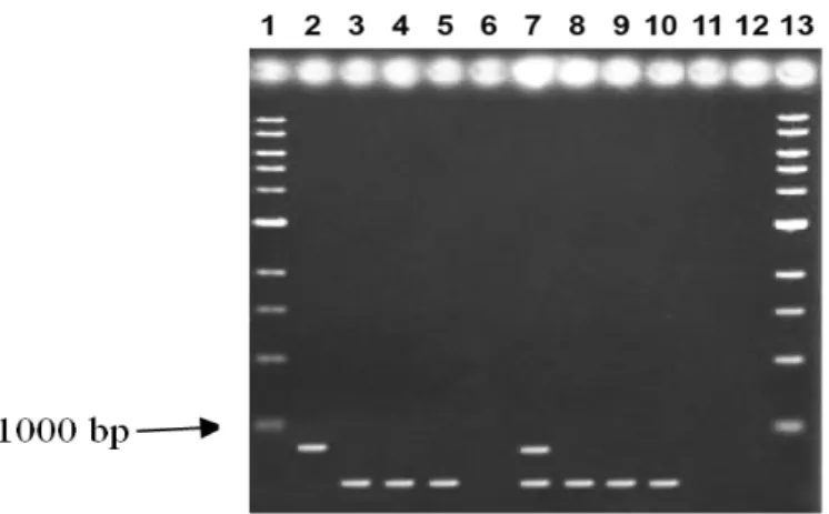 Figure  4  -  Multiplex  PCR  results  in  1%  agarose  gel  showing  amplifications  of  genomic  DNA