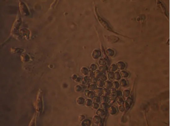 Figure 1 - Hybridoma colony formation after an incubation of seven days. 