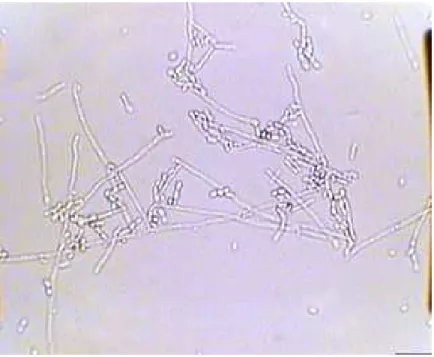 Figure 1 - Candida parapsilopsis (400 x).