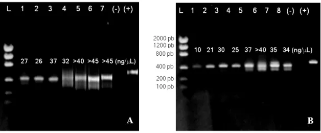 Figure 1 - Electrophoresis in 1% agarose  gel of the amplifications of spacer ITS1 (A)  and ITS2  (B) of the nuclear ribosomal DNA of Drosera species