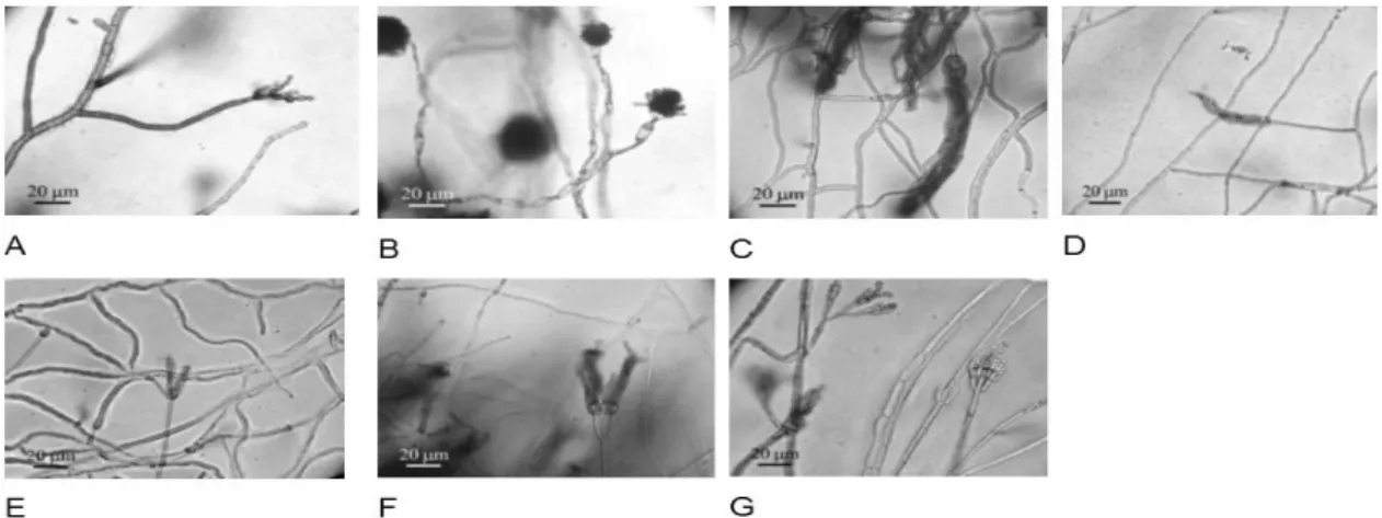 Figure  2  -  Development of reproductive structures in Malt Extract agar. Microscopical  analyses  were performed after incubation for five days at 26 °C ± 2 °C