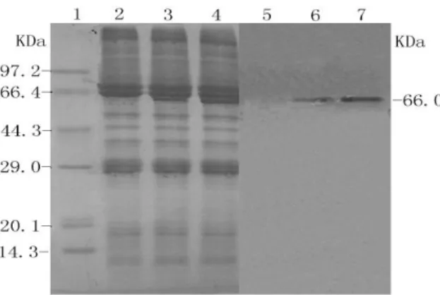 Figure  4  -  Analysis  of  recombinant  UreB  using  SDS- SDS-PAGE and western blotting 1