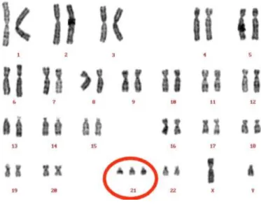 Figura 1 – Cromossoma 21  