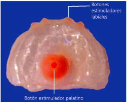 Figura 2 – Placa palatina  Fonte: scielo.cl  