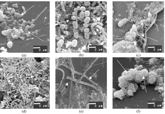 Figure 3 - Morphological incidence. (a - rods attached individually to the polyurethane surface; b - cocci attached to rods; c -  Extracellular polymeric substance; d - rods;
