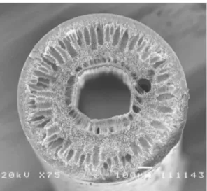 Figure 2 -Hollow fiber membrane, transversal cross-section (75x).