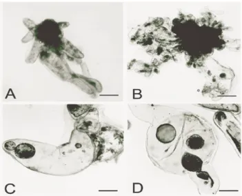 Figure 1 - A-D - Cell line characterization in embryogenic suspension cultures of  A. angustifolia  A) Pro-embryos in BM culture medium free of growth regulators (BM0) (bar