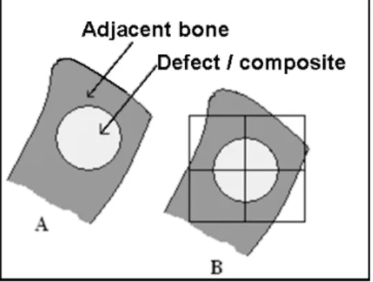 Figure 1 - Schematic drawings, defects seen in medial-lateral radiographs (A) and divided into four  quadrants (B)