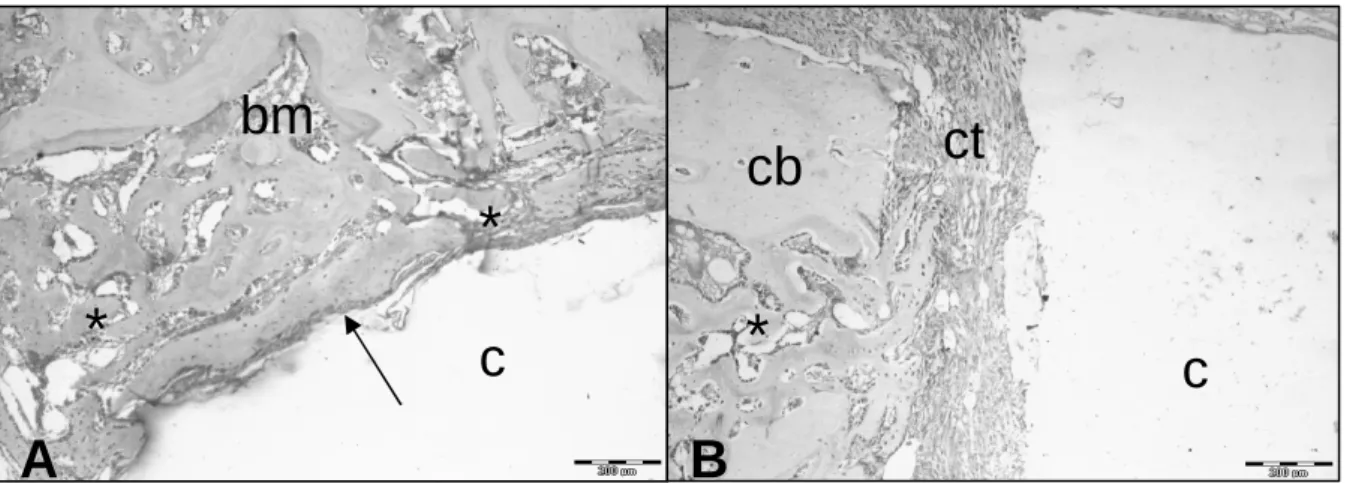 Figure 5 - Histological view of the defect in the HP group, with hydroxyapatite-polyhydroxybutyrate  composite  (c)