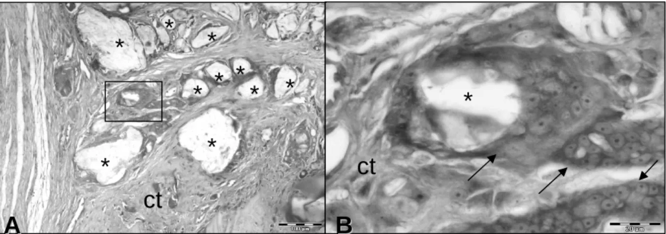 Figure 7 - A- Lateral region of the defect on the 90th day. Composite fragments (*) separated from the  original block within vascularized, dense connective tissue (ct) covering the defect’s lateral  surface