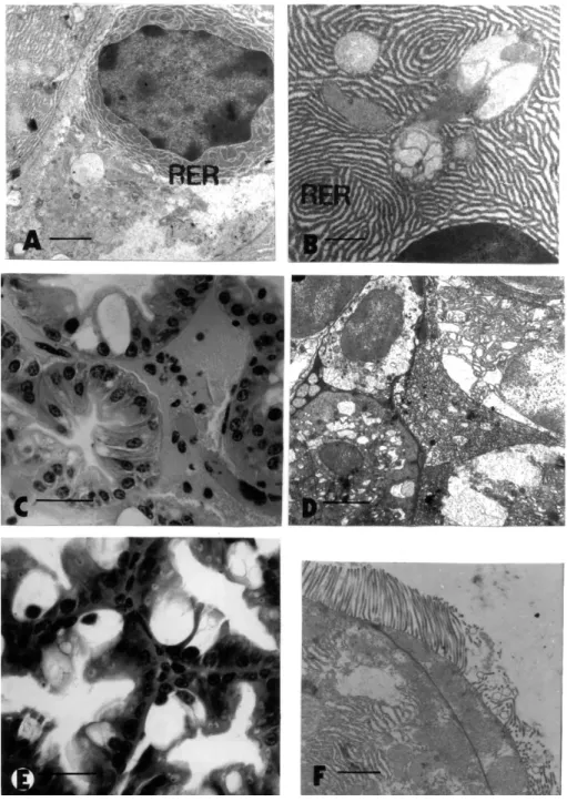 Figure  4  -  A,  D.  Salinity  induced  alterations  in  the  hepatopancreas  after  30  days  from  the  beginning of the experiment