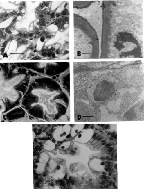 Figure 5 - A, D. Salinity induced alterations in the hepatopancreas after 60 days. –A, B