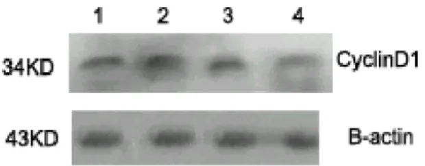 Figure 7 - CyclinD1 expression inhibition of E2F decoy DNA in PC-3M cells were analyzed by Western  blotting after 24h of transfection