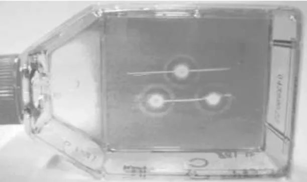 Figure  5  -  The  T-15  flask  after  three  37MBq  (1mCi)  Ho-166  seed  irradiation,  with  spacer  withdrawal and cell fixed and dyed