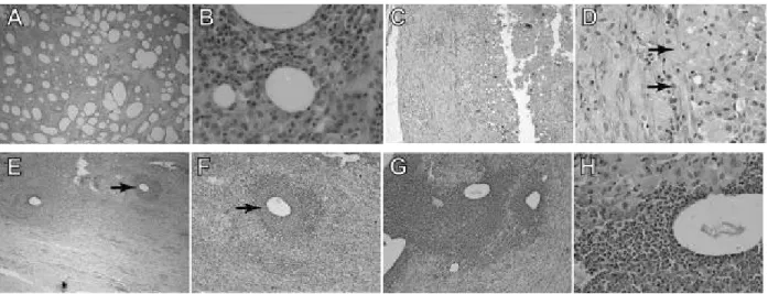 Figure  4  -  Photomicrographs  of  the  rabbits  tissue  reactions  induced  by  the  injection  of  different  adjuvants:  A  and  B  –  Freund’s  adjuvant  showing  disperse  vacuolation  separated  by  collagen  with  significant  infiltration  of  mon