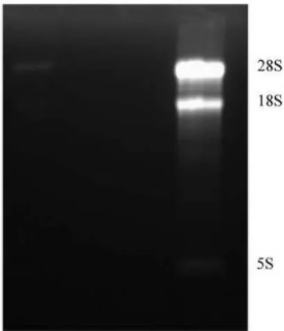 Figure 1  - Electrophoretogram of total RNA through a 1% (w/v) agarose gel. Total RNA was  extracted from peach fruit, and analyzed throush 1% (w/v) agarose gel