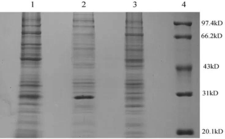 Figure 5 - Expression of His-tagged SDH fusion protein in E. coli and purification of the 6×His-tag  recombinant SDH  with  Ni-NTA