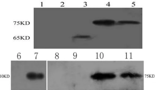 Figure  1  -  Identification  of  fusion  protein  Hsp65-  ESAT-6  by  Western  blot.  The  fusion  protein  expressed in HepG-2 cell line could be recognized by anti-Hsp65 MoAb and anti-ESAT-6  MoAb, respectively