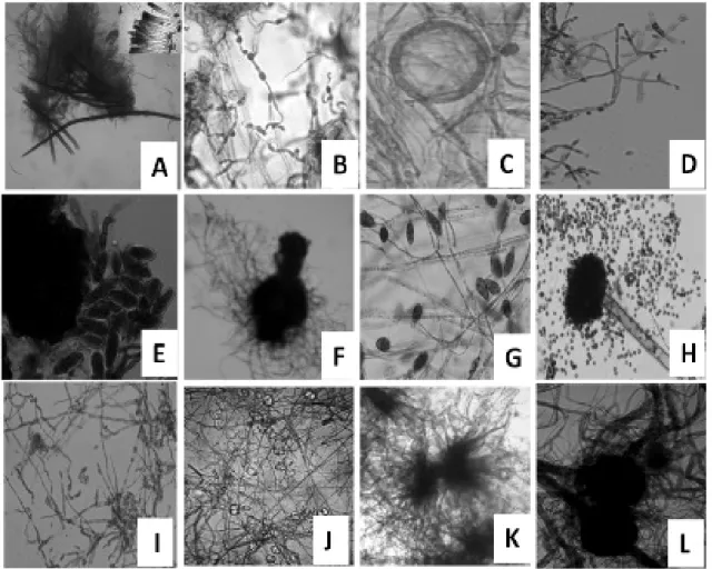 Figure  1  -  Light  micrographs  of  endophytic  fungi  associated  with  Bacopa  monnieri    at  400X  magnification A) B1, B) B2, C) B3 D) B4, E) B8, F) B10, G) B13, H) B14, I) B16, J)  B19, K) B8_ORG, L) B15