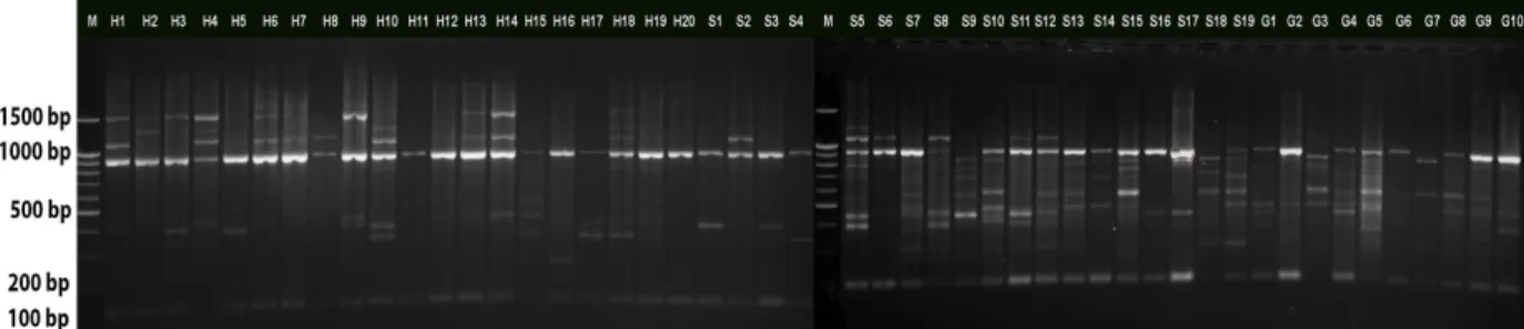 Figure  3  -  RAPD  banding  patterns  obtained  with  primer  S395.  Lanes  H1-H20:  Methicillin-resistant  Staphylococcus  aureus  strains  from  Hospital-1,  Lanes  S1-S19:  Methicillin-resistant  Staphylococcus  aureus  strains  from  Hospital-2,  Lane