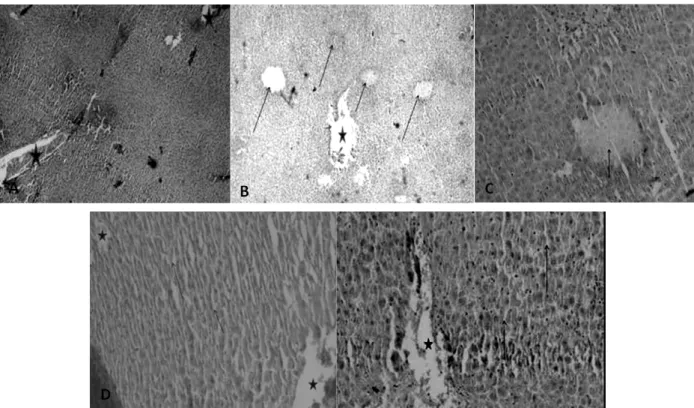 Figure  12  -  Effect  of  Hypericum  scabrum  essential  oil  on  histopathological  changes  24h  after  APAP  administration