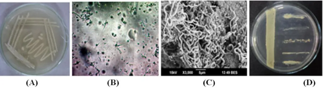 Figure 1 - Streptomyces parvulus  VITJS11- (A) Pure culture plate of on starch casein agar; (B) Light  microscopy at 40X; (C) Scanning electron microscopy; (D) Cross streak assay of the strain  against the bacterial pathogens.