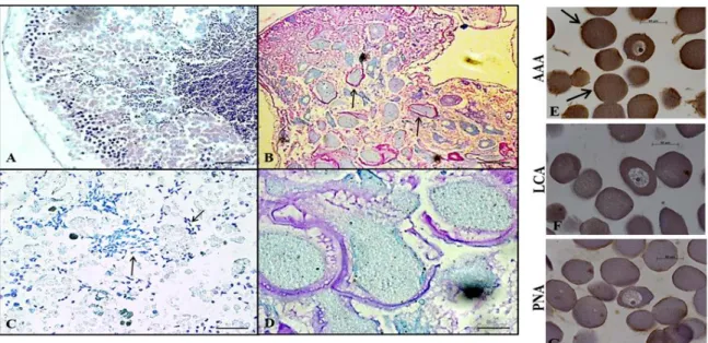 Figure 3 - A-D: Light micrographs of the male (Panel A, x40) and female (Panel B, x40) gonads of the sea urchin  and of suspension of the sperm (Panel C, x100) and spawned eggs (Panel D, x100), all stained with toluidine blue