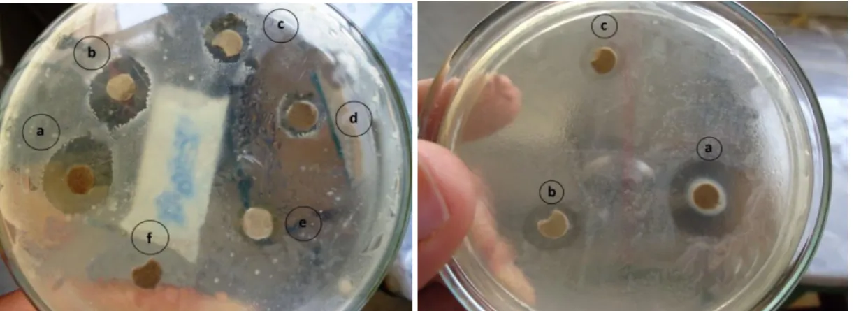 Figure 7 -  Zone of inhibition for antimicrobial activity of CoP 1  (right pic: (a) S