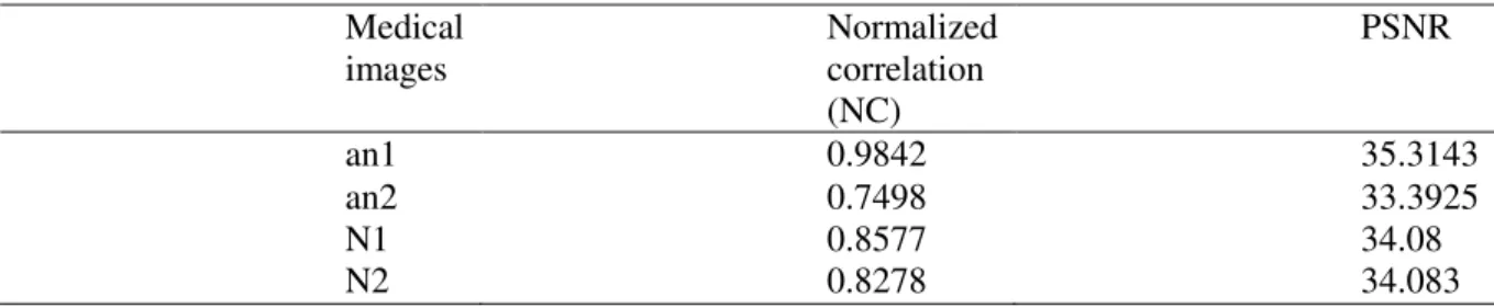 Table 1: Normalized correlation (NC) and PSNR value for the medical images. 