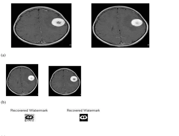 Figure 4.  (a) Original medical images of human brain, (b) Watermarked image, (c) Recovered Watermark