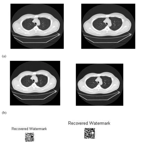 Figure  5:  (a)  Original  medical  image  of  human  lungs  (N1  and  N2),  (b)  Watermarked  image,  (c)  Recovered  Watermark