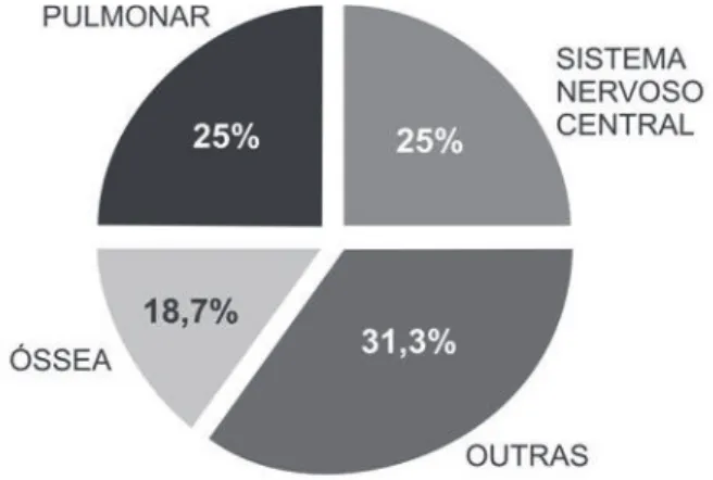 Figura 1. Percentual de casos de melanoma por localização da  lesão, Hospital de Clínicas – Universidade Federal do Paraná (UFPR)