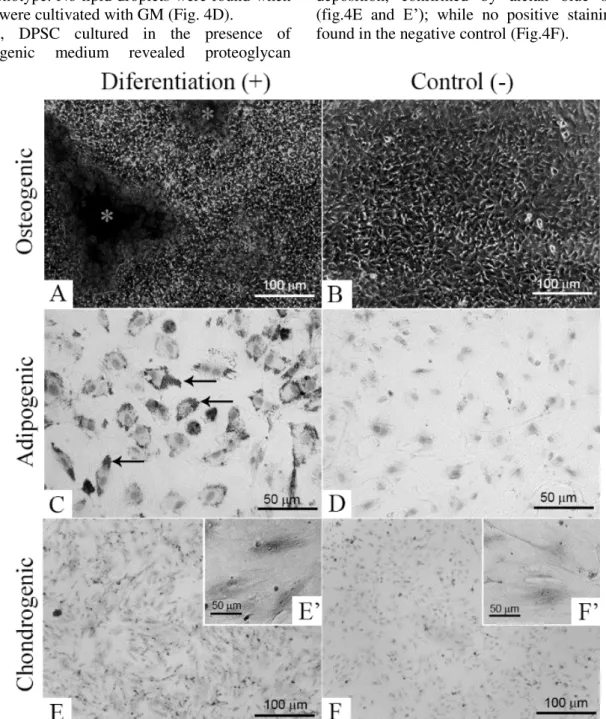 Figure  4.  DPSC  differentiation  in  osteogenic,  adipogenic  and  chondrogenic  cell  fates