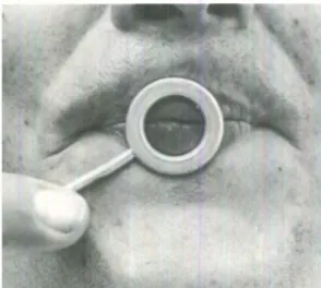 Figura 5: Equilíbrio correto dos lábios   (Fonte: Farkas, 1962, p. 26) 