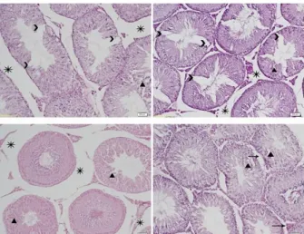 Figure  8:  Testicular  sections  of  mercury  chloride  treated  rats  showing  separating  of  cells  from  basal  region (→), edema in interstitial tissue (*), degenerative  changes  in  seminiferous  tubules  (▲)  and  decreasing  number of spermatogen