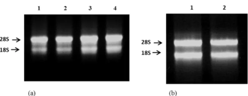 Figure 1. Visual analysis of RNA extracted using modified method. The RNAs were resolved with 1% agarose gel  stained with ethidium bromide in 1X TAE
