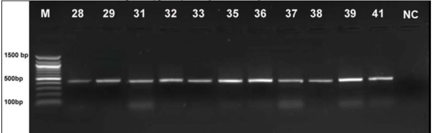 Figure  1.  OXA-48 type  carbapenemase  of  E.coli  strains  (28-41; E.coli,  NC;  Negative  control,  M;  100  bp  DNA  molecular marker)