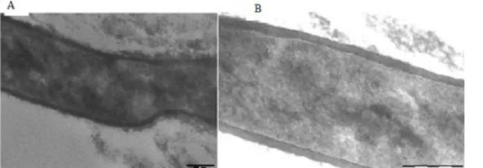 Fig.  2  showed  the  characters  of  the  fine  structure  of  the  cell  wall  of  the  control  S