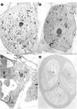 Figure 2 - Transmission electron microscope photographs of pollen grain development in papaya
