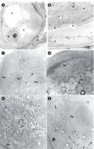 Figure 3 - Ultra structural microphotographs of late phase of pollen grain development