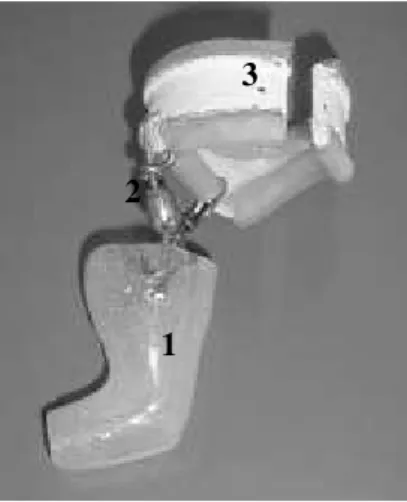 Figure 1 - Orthosis in the neutral ankle position, consisting of an acrylic resin model (1), lateral  rotators (2) and an abdominal belt (3)